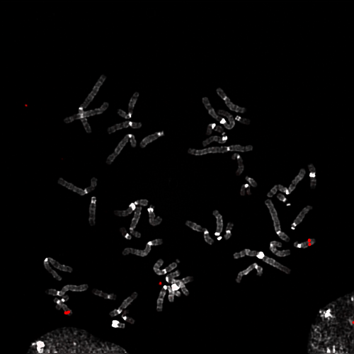 cytogenetics